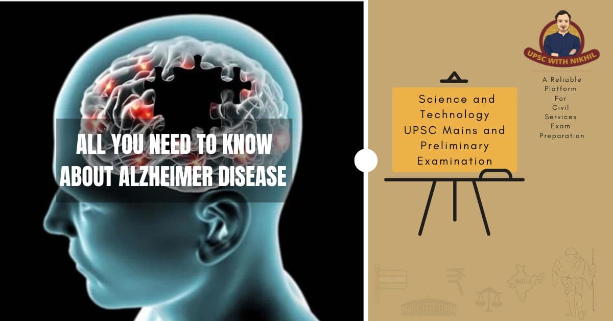 All You Need To Know About Alz